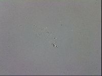 Mesobiotus coronatus image
