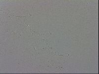 Mesobiotus coronatus image