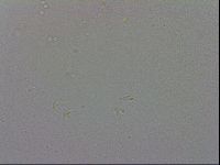 Mesobiotus coronatus image