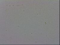 Mesobiotus coronatus image