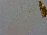 Mesobiotus coronatus image