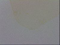 Mesobiotus coronatus image