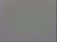 Mesobiotus coronatus image