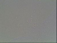 Mesobiotus coronatus image