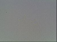 Mesobiotus coronatus image