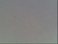 Mesobiotus coronatus image