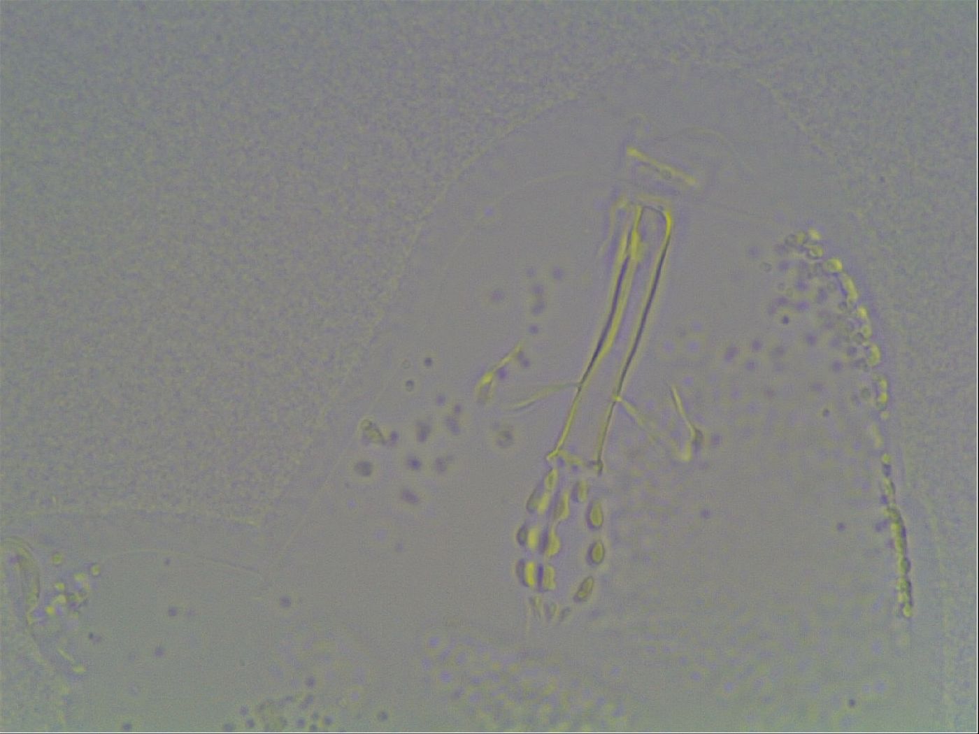 Mesobiotus coronatus image