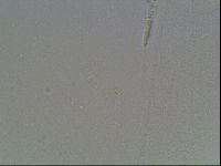 Mesobiotus coronatus image