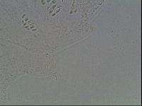Mesobiotus coronatus image