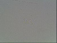 Mesobiotus coronatus image