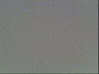 Mesobiotus coronatus image