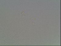 Mesobiotus coronatus image