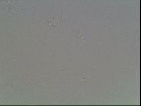 Mesobiotus coronatus image
