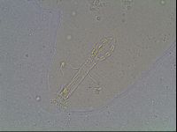 Mesobiotus coronatus image