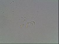 Mesobiotus coronatus image
