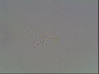 Mesobiotus coronatus image