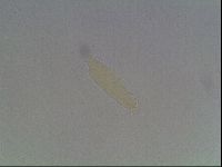 Mesobiotus coronatus image