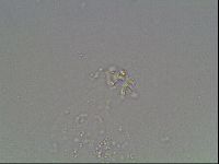 Mesobiotus coronatus image