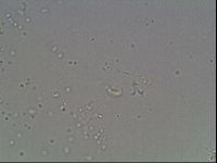 Mesobiotus coronatus image