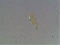 Mesobiotus coronatus image