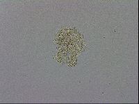 Mesobiotus coronatus image