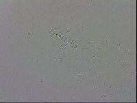 Mesobiotus coronatus image