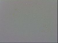 Mesobiotus coronatus image
