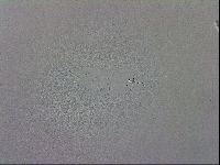 Mesobiotus coronatus image