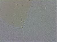 Mesobiotus coronatus image