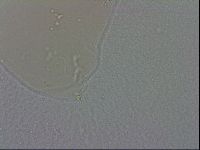 Mesobiotus coronatus image