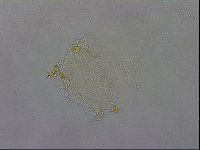 Mesobiotus coronatus image
