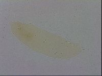 Mesobiotus coronatus image