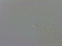 Mesobiotus coronatus image