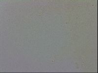 Mesobiotus coronatus image