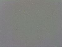 Mesobiotus coronatus image