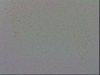Mesobiotus coronatus image