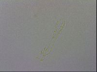 Mesobiotus coronatus image