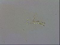 Mesobiotus coronatus image