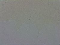 Mesobiotus coronatus image