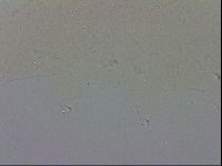 Mesobiotus coronatus image