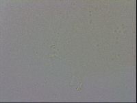 Mesobiotus coronatus image