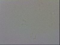 Mesobiotus coronatus image