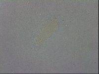 Mesobiotus coronatus image