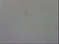 Mesobiotus coronatus image