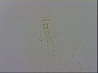 Mesobiotus coronatus image