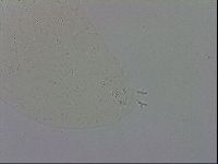 Mesobiotus coronatus image