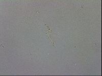Mesobiotus coronatus image