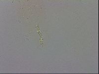 Mesobiotus coronatus image