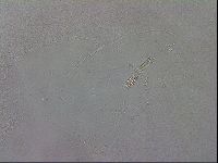 Mesobiotus coronatus image