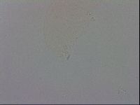 Mesobiotus coronatus image